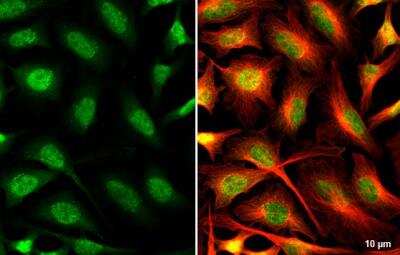 Immunocytochemistry/ Immunofluorescence: O-GlcNAc Transferase p110 subunit Antibody [NBP1-32791]