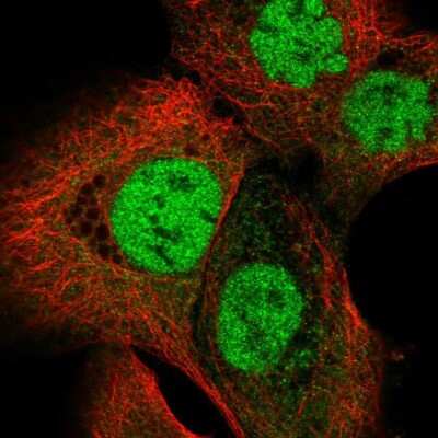 Immunocytochemistry/ Immunofluorescence: O-GlcNAc Transferase p110 subunit Antibody [NBP2-55252]