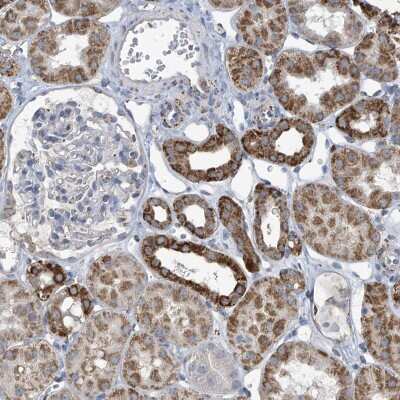 Immunohistochemistry: O-GlcNAc Transferase p110 subunit Antibody [NBP2-48598]