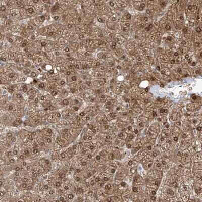 Immunohistochemistry-Paraffin: O-GlcNAc Transferase p110 subunit Antibody [NBP1-89845]