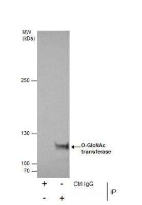 Immunoprecipitation: O-GlcNAc Transferase p110 subunit Antibody [NBP1-32791]