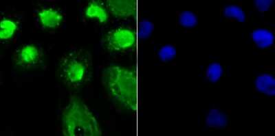 Immunocytochemistry/ Immunofluorescence: O-GlcNAc Transferase p110 subunit Antibody (JB44-39) [NBP2-75601]