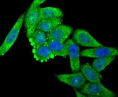 Immunocytochemistry/ Immunofluorescence: O-GlcNAc Transferase p110 subunit Antibody (JB44-39) [NBP2-75601]
