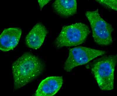Immunocytochemistry/ Immunofluorescence: O-GlcNAc Transferase p110 subunit Antibody (JB44-39) [NBP2-75601]