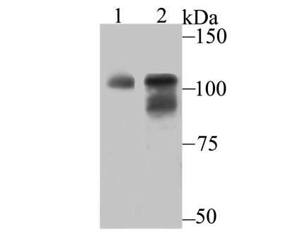 Western Blot: O-GlcNAc Transferase p110 subunit Antibody (JB44-39) [NBP2-75601]
