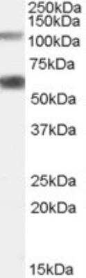 Western Blot: O-GlcNAc Transferase p110 subunit Antibody [NB100-57845]