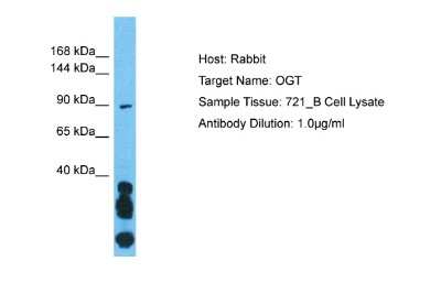 Western Blot: O-GlcNAc Transferase p110 subunit Antibody [NBP1-52925]