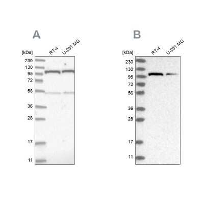 Western Blot: O-GlcNAc Transferase p110 subunit Antibody [NBP2-55252]