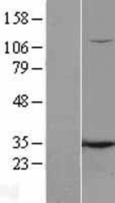 Western Blot: O-GlcNAc Transferase p110 subunit Overexpression Lysate [NBL1-13919]