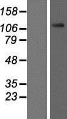 Western Blot: O-GlcNAc Transferase p110 subunit Overexpression Lysate [NBP2-04900]