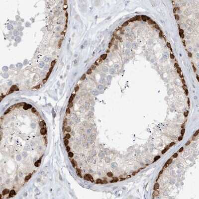 Immunohistochemistry-Paraffin: O-GlcNAcase/OGA/MGEA5 Antibody [NBP1-81244]