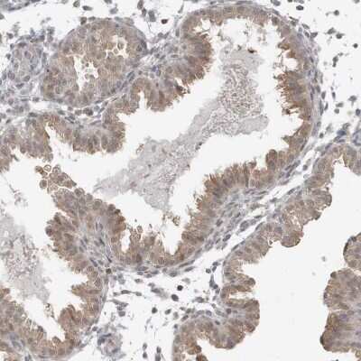 Immunohistochemistry-Paraffin: O-GlcNAcase/OGA/MGEA5 Antibody [NBP1-81244]