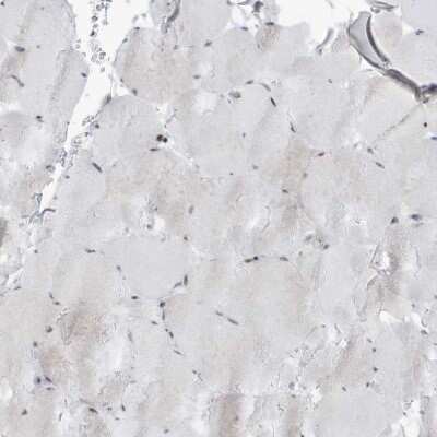 Immunohistochemistry-Paraffin: O-GlcNAcase/OGA/MGEA5 Antibody [NBP1-81244]