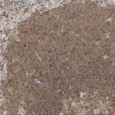 Immunohistochemistry-Paraffin: O-GlcNAcase/OGA/MGEA5 Antibody [NBP1-81244]