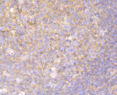 Immunohistochemistry-Paraffin: O-GlcNAcase/OGA/MGEA5 Antibody (JG40-05) [NBP2-76848]