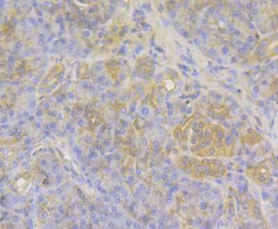 Immunohistochemistry-Paraffin: O-GlcNAcase/OGA/MGEA5 Antibody (JG40-05) [NBP2-76848]