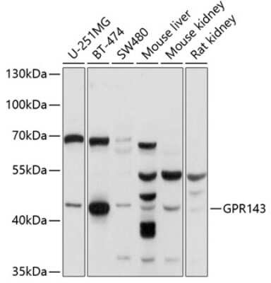 Western Blot: OA1 AntibodyBSA Free [NBP2-94189]