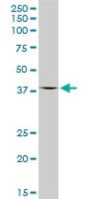 Western Blot: OAS1 Antibody [H00004938-D01P]