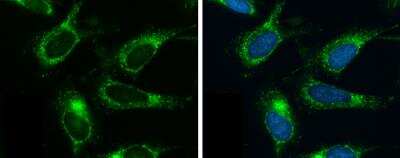 Immunocytochemistry/ Immunofluorescence: OAT Antibody [NBP1-32390]