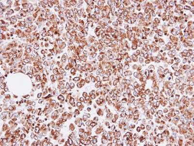 Immunohistochemistry-Paraffin: OAT Antibody [NBP1-32390]