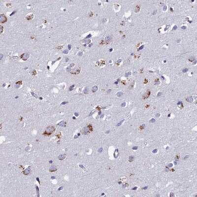 Immunohistochemistry-Paraffin: OAT Antibody [NBP1-83239]