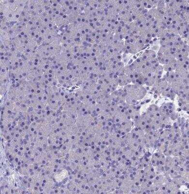 Immunohistochemistry-Paraffin: OAT Antibody [NBP1-83239]