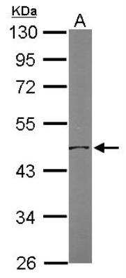 Western Blot: OAT Antibody [NBP1-32390]