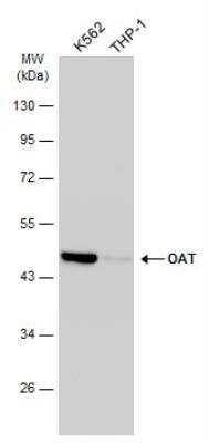 Western Blot: OAT Antibody [NBP1-32390]