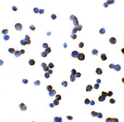 Immunocytochemistry/ Immunofluorescence: OATP1B1/OATP2 Antibody - BSA Free [NBP2-81750]