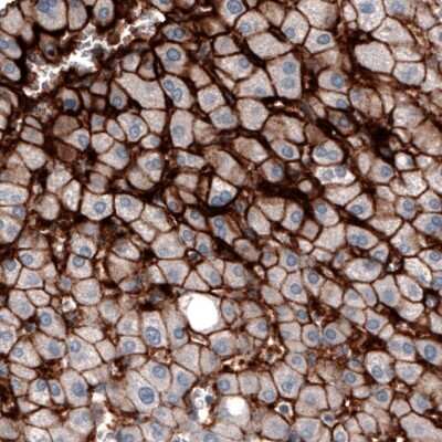 Immunohistochemistry-Paraffin: OATP1B3/SLCO1B3/OATP8 Antibody (CL3771) [NBP2-61637]