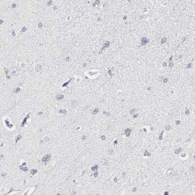 Immunohistochemistry-Paraffin: OATP1B3/SLCO1B3/OATP8 Antibody [NBP1-80980]
