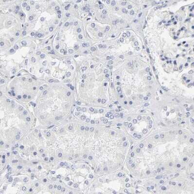 Immunohistochemistry-Paraffin: OATP1B3/SLCO1B3/OATP8 Antibody [NBP1-80980]