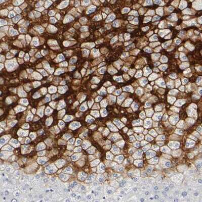 Immunohistochemistry-Paraffin: OATP1B3/SLCO1B3/OATP8 Antibody [NBP1-80980]