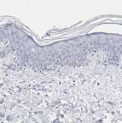 Immunohistochemistry-Paraffin: OATP1B3/SLCO1B3/OATP8 Antibody [NBP1-80980]