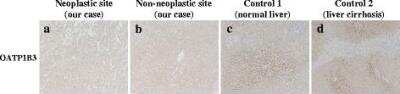 Immunohistochemistry: OATP2/8 Antibody (MDQ) [NB100-74482]