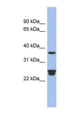 Western Blot: OAZ2 Antibody [NBP1-70661]
