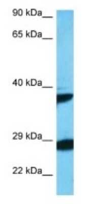 Western Blot: OBCAM/OPCML Antibody [NBP3-09427]