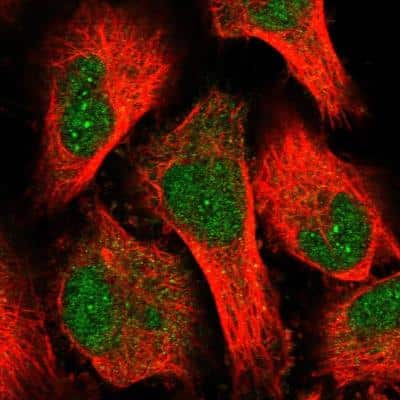 Immunocytochemistry/ Immunofluorescence: OBFC1 Antibody [NBP1-88744]