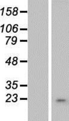 Western Blot: OBFC2A Overexpression Lysate [NBP2-08591]