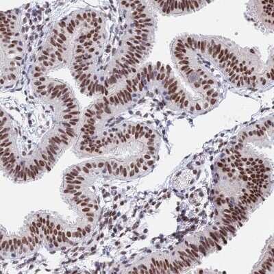 Immunohistochemistry-Paraffin: OBFC2B Antibody [NBP1-82718]