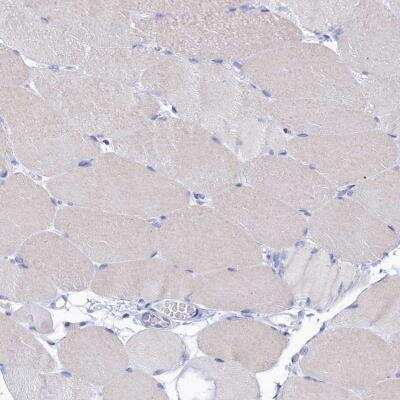 Immunohistochemistry-Paraffin: OCIAD2 Antibody [NBP1-82683]