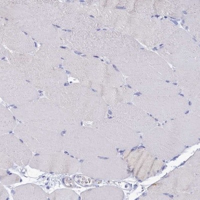 Immunohistochemistry-Paraffin: OCIAD2 Antibody [NBP1-82682]