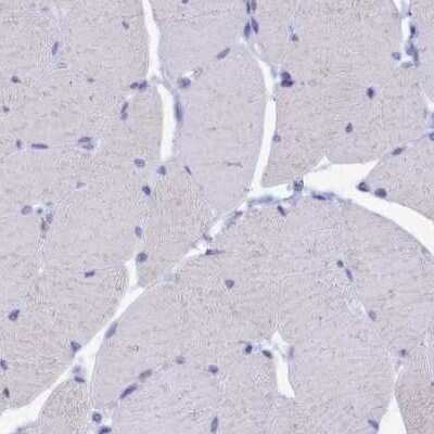 Immunohistochemistry-Paraffin: OCIAD2 Antibody [NBP1-82682]