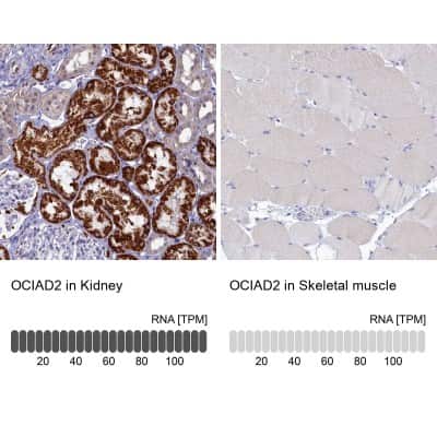 Immunohistochemistry-Paraffin: OCIAD2 Antibody [NBP1-82683]