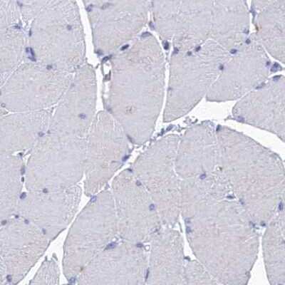 Immunohistochemistry-Paraffin: OCIAD2 Antibody [NBP1-82683]