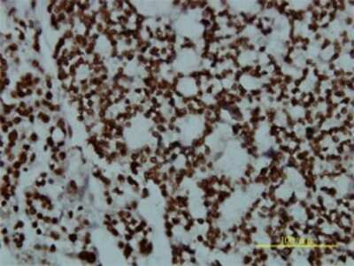 Immunohistochemistry-Paraffin: POU2F2 Antibody (3E3-6F9) [H00005452-M01]