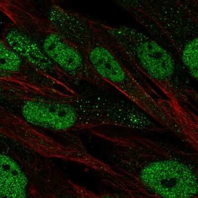 Immunocytochemistry/ Immunofluorescence: POU2F2 Antibody [NBP2-68683]