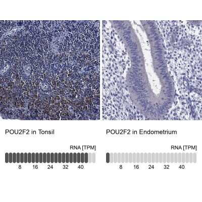 Immunocytochemistry/ Immunofluorescence: OCT2 Antibody [NBP3-16966]
