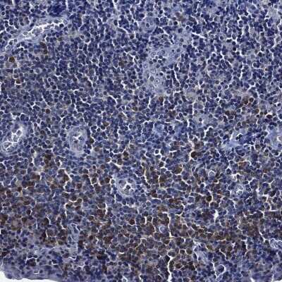 Immunohistochemistry-Paraffin: OCT2 Antibody [NBP3-16966]