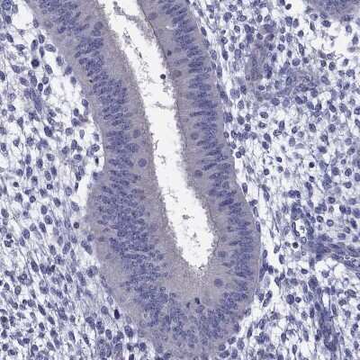 Immunohistochemistry-Paraffin: OCT2 Antibody [NBP3-16966]